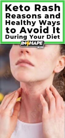 Keto Rash: Reasons and Healthy Ways to Avoid It during Your Diet